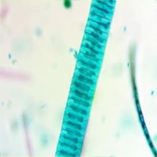 Slide, Microscope, Diatoms