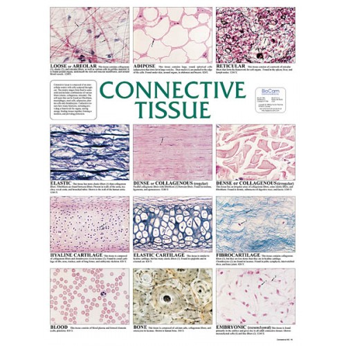 Chart, Connective Tissue